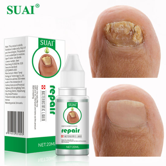 Sway Toenail Fungus Treatment Gel Foot Care Anti Infective Paronychia Onychomycosis
