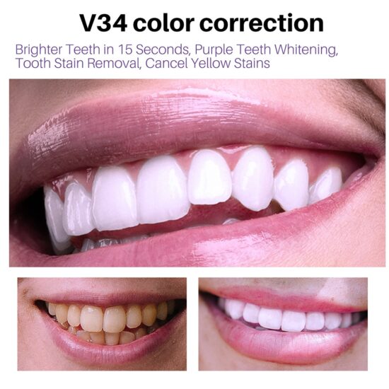 Teeth Whitening Deep Cleaning Cigarette Stains Repair Bright Neutralizes Yellow Tones Dental Plaque And Fresh Breath - Image 3