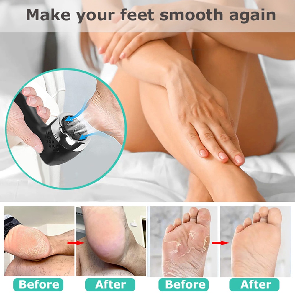 Electric Foot Rasp Electric Pedicure Foot Sander Rechargeable IPX7 Waterproof to Eliminate Feet Dead Skin and Calluses